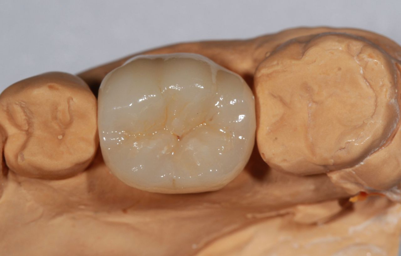 Jesus De La Cruz Ballinas-33