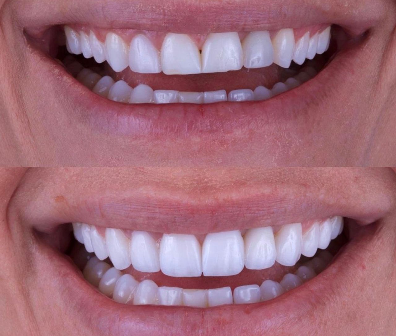 Ernesto Rojas Calderon-42