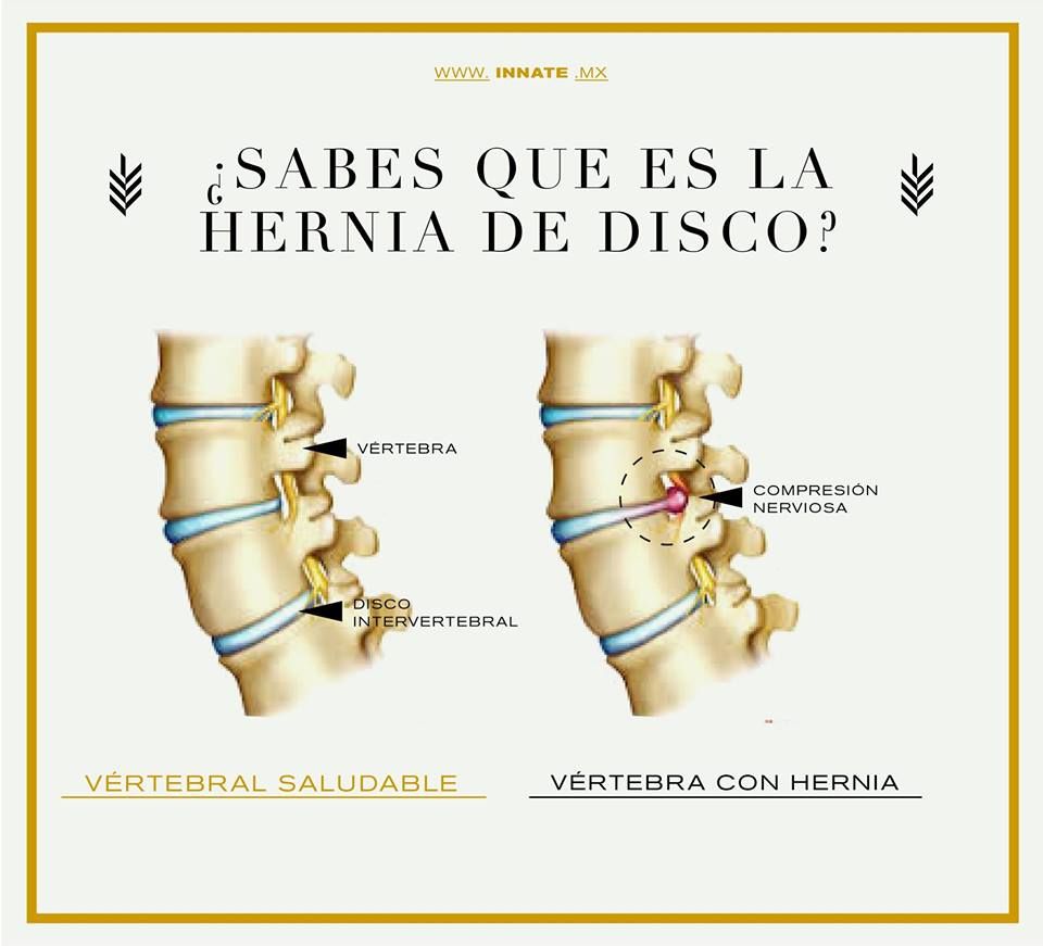 Esteban Hernandez Maza-13