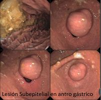 Edgar Alan De León Rojas-23