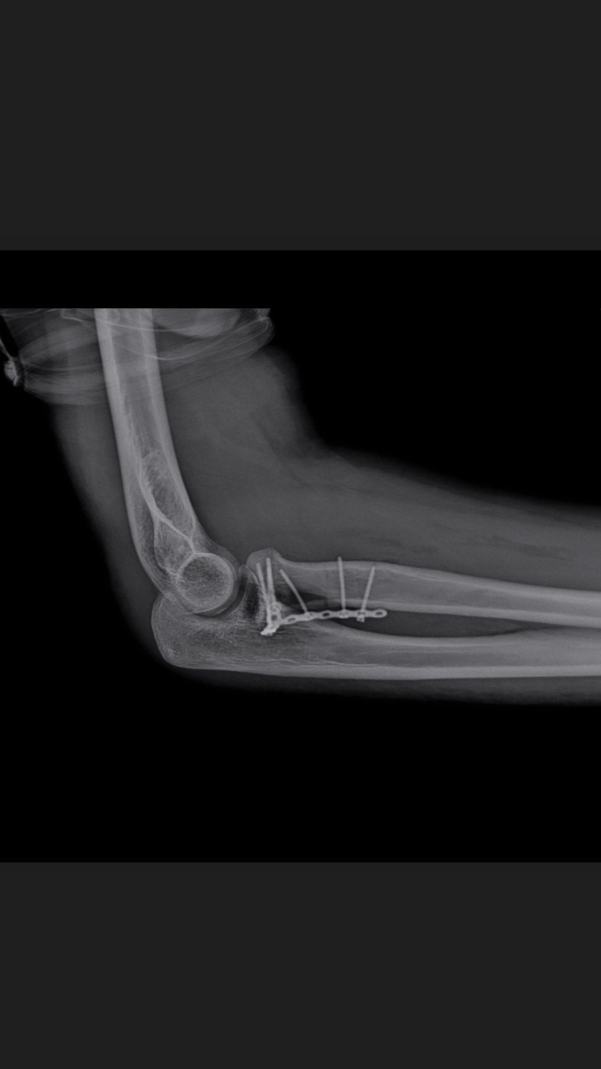 Carlos Humberto Vera Torres-0