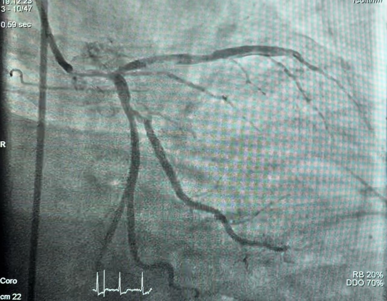 Abdón Ávila Chávez-48