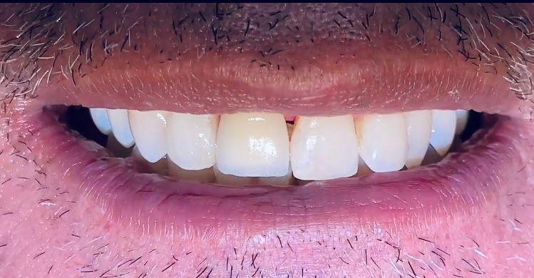 Alberto Miguel Rodriguez Soto-40