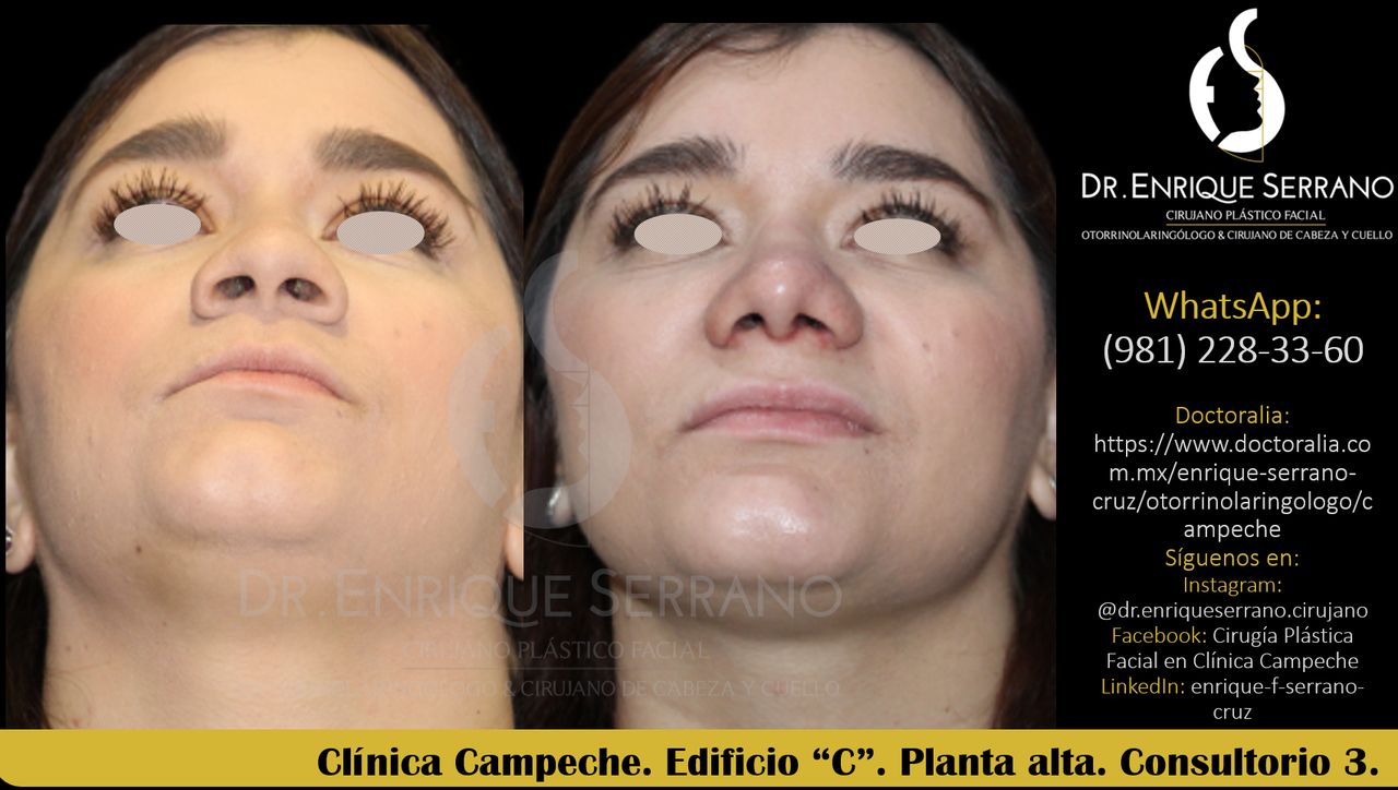 Enrique Serrano Cruz-73