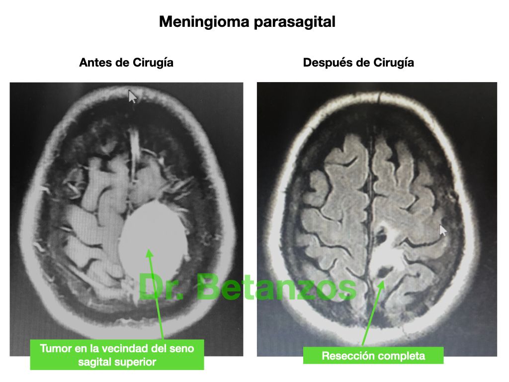 Aleixandre Betanzos Villegas-8