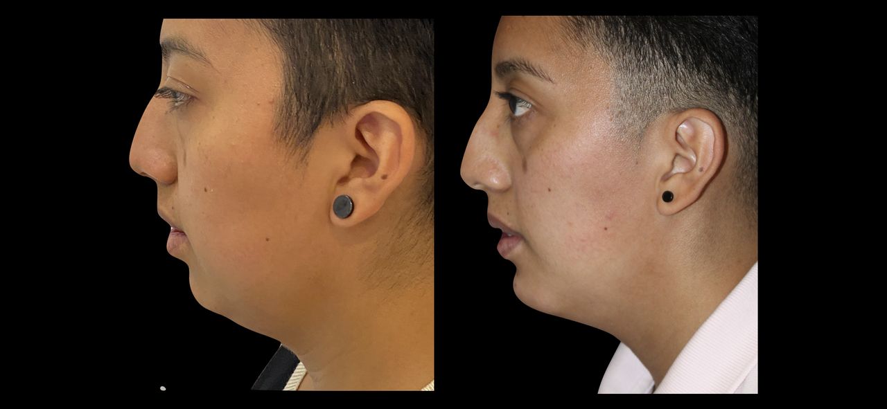 Giovani Ramírez Limón-12