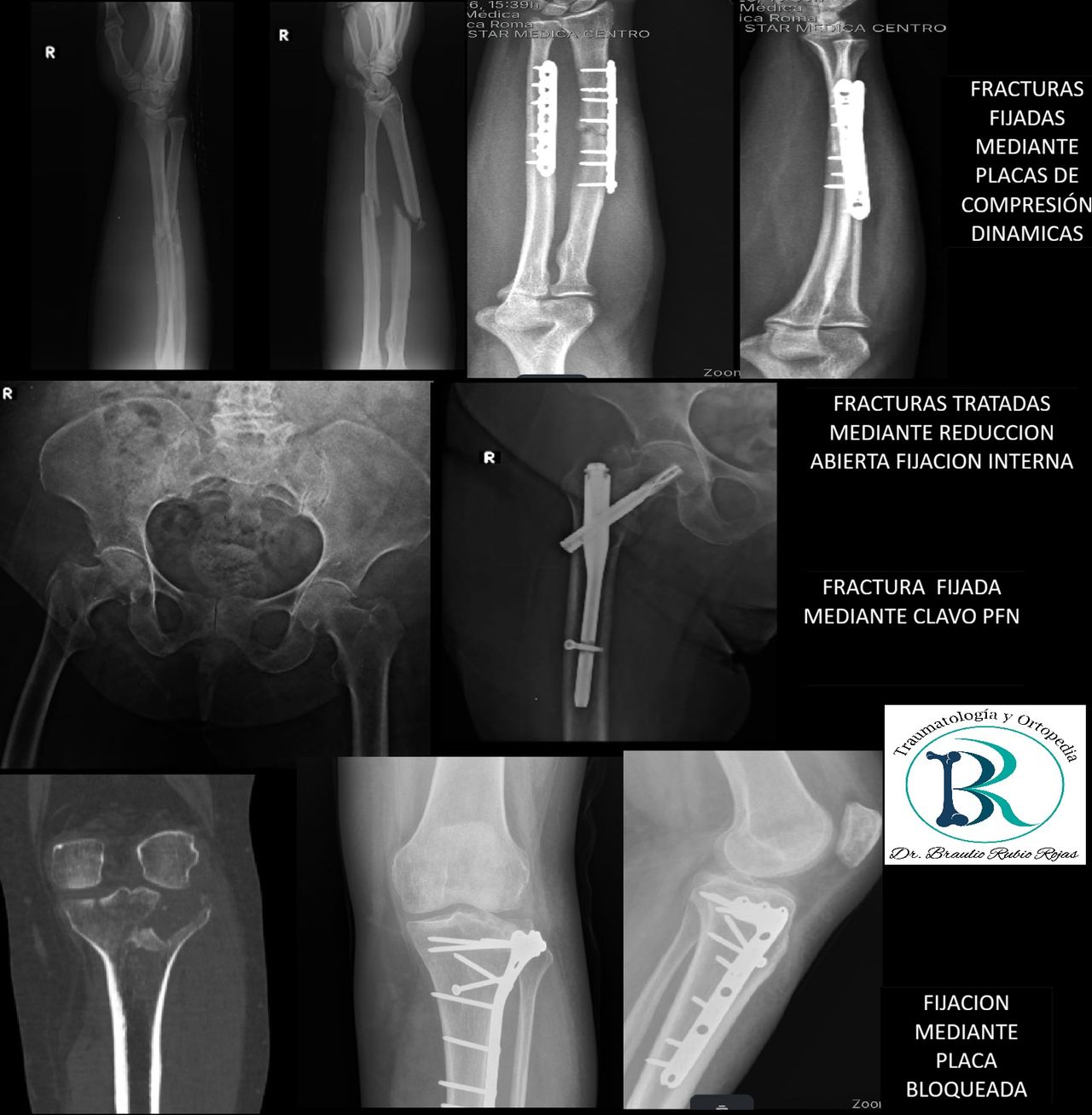 Braulio Rubio Rojas-6