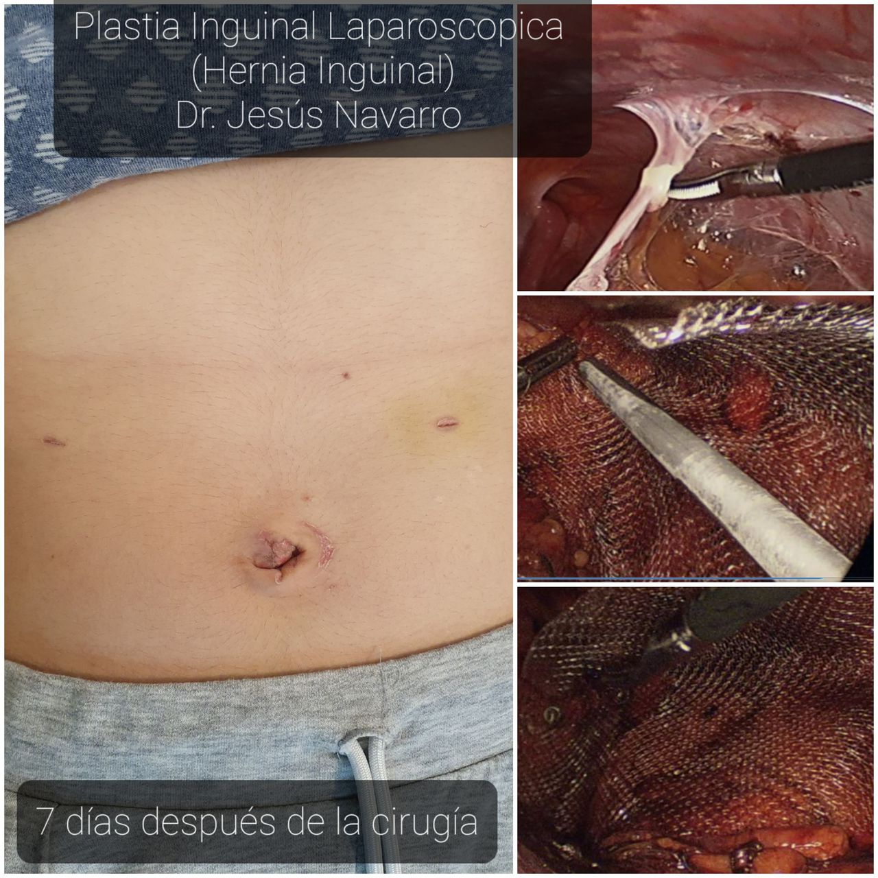 Jesús Navarro Esparza-7