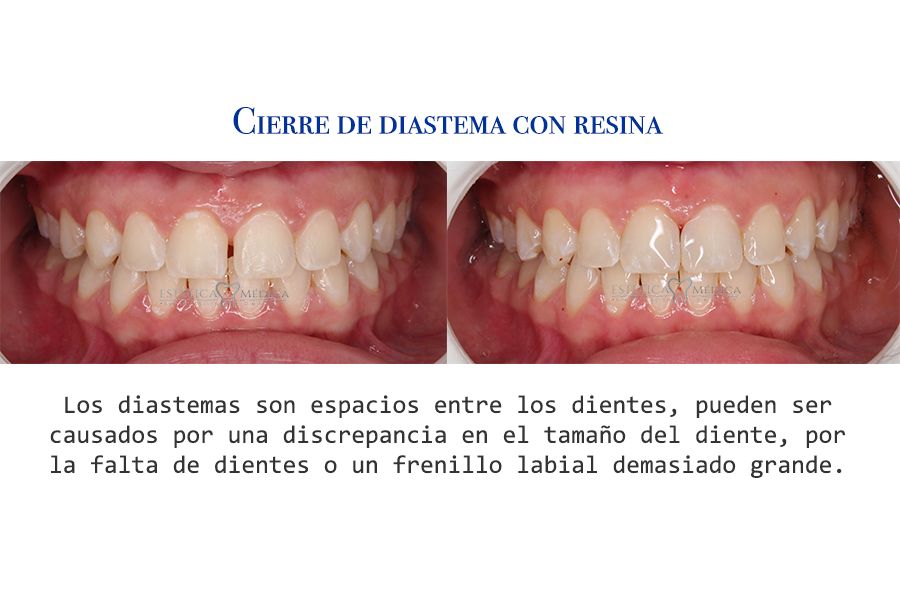 Bielmy Veronica Jonapa Peña-28