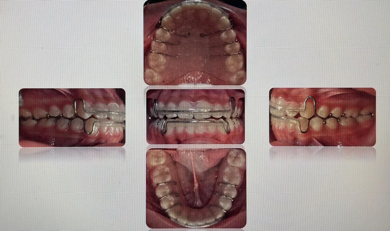 Antonio Gomez Arenas-18