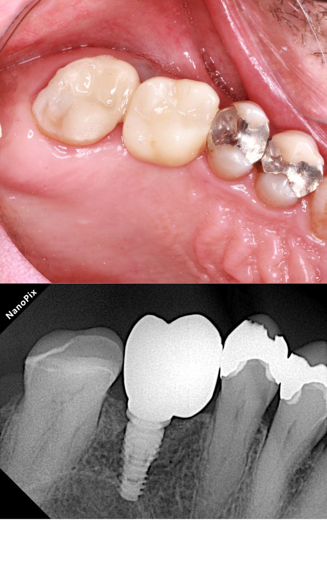 Heidi Mendoza Malagón-11