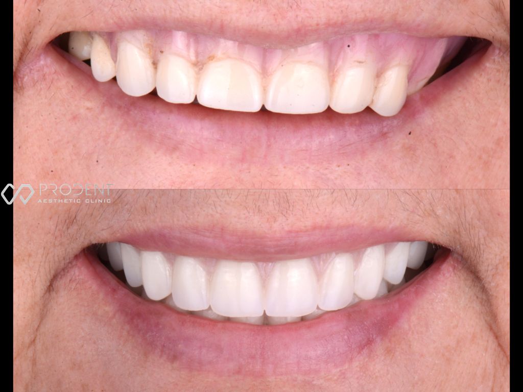 Ulises Pérez Murillo-69