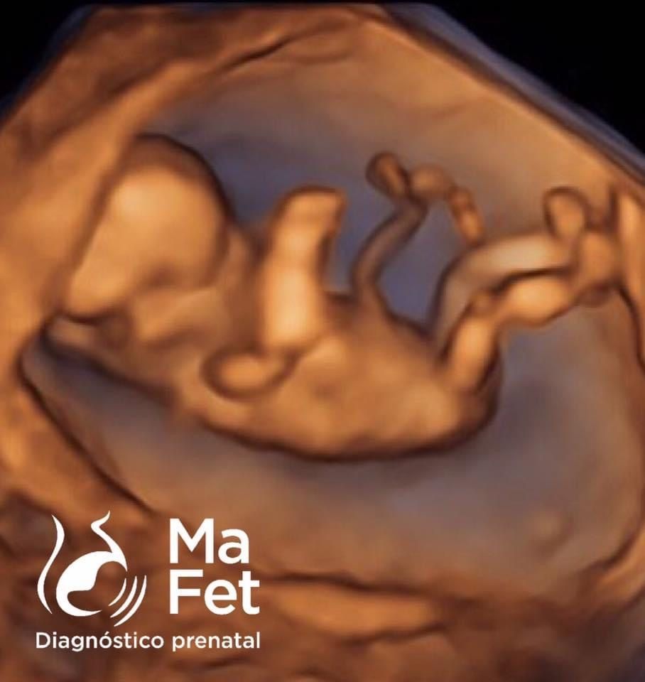 Gabriela Cabrera Lopez-25