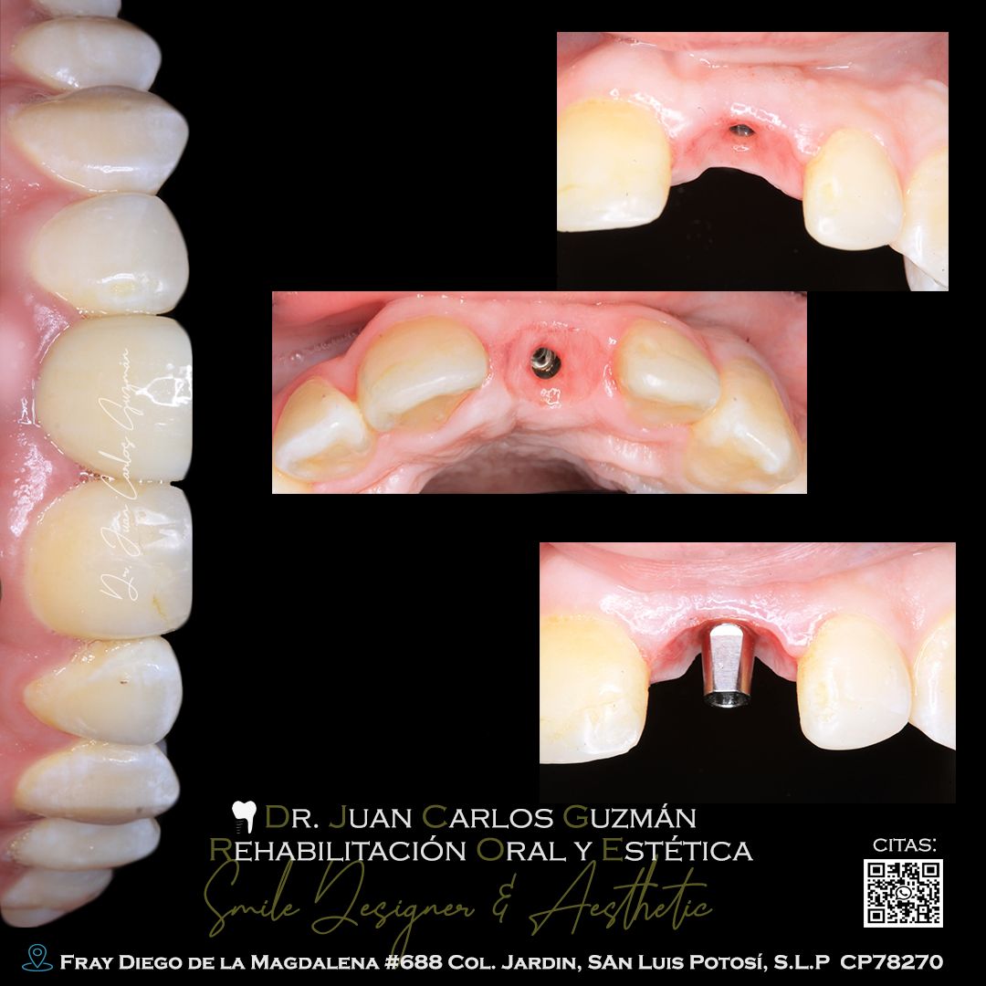 Juan Carlos Guzmán Castañeda-33