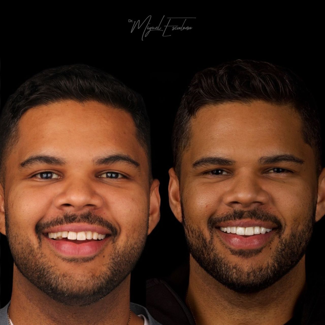 Miguel Alberto Escalona Mora-7