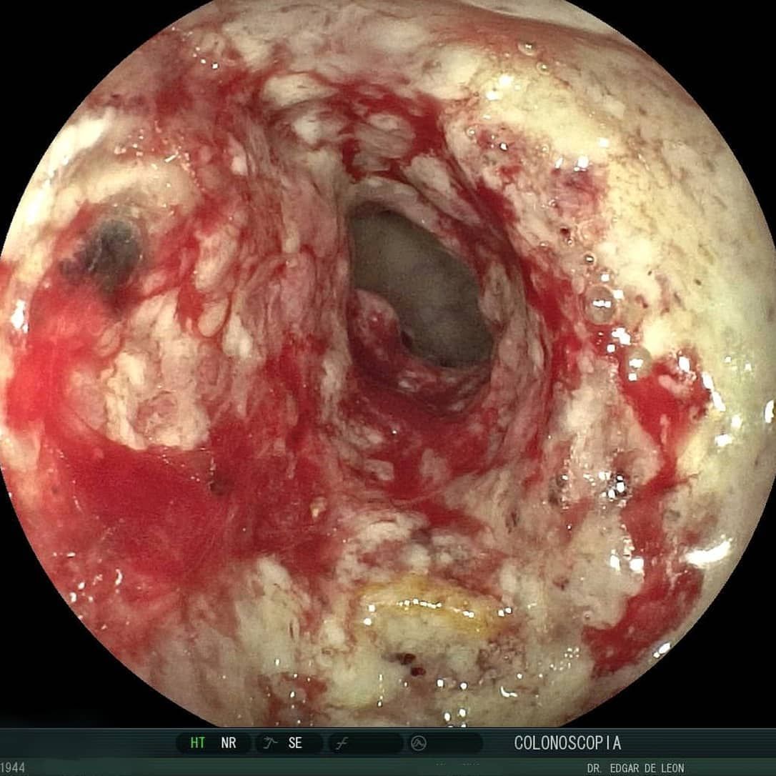 Edgar Alan De León Rojas-17