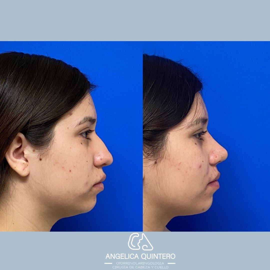 Angélica Gutiérrez Quintero-3