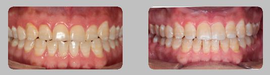 Javier Ibáñez Brambila-5