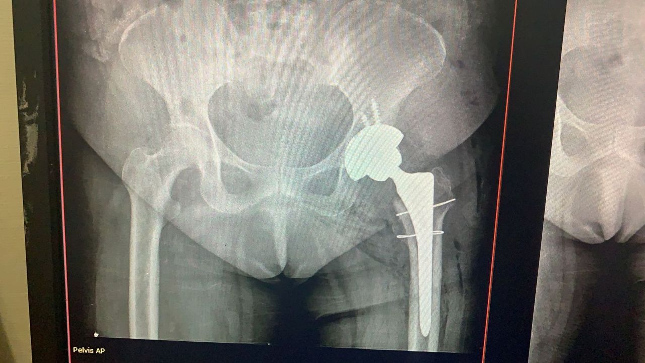 Sergio Espinosa Espinoza-9