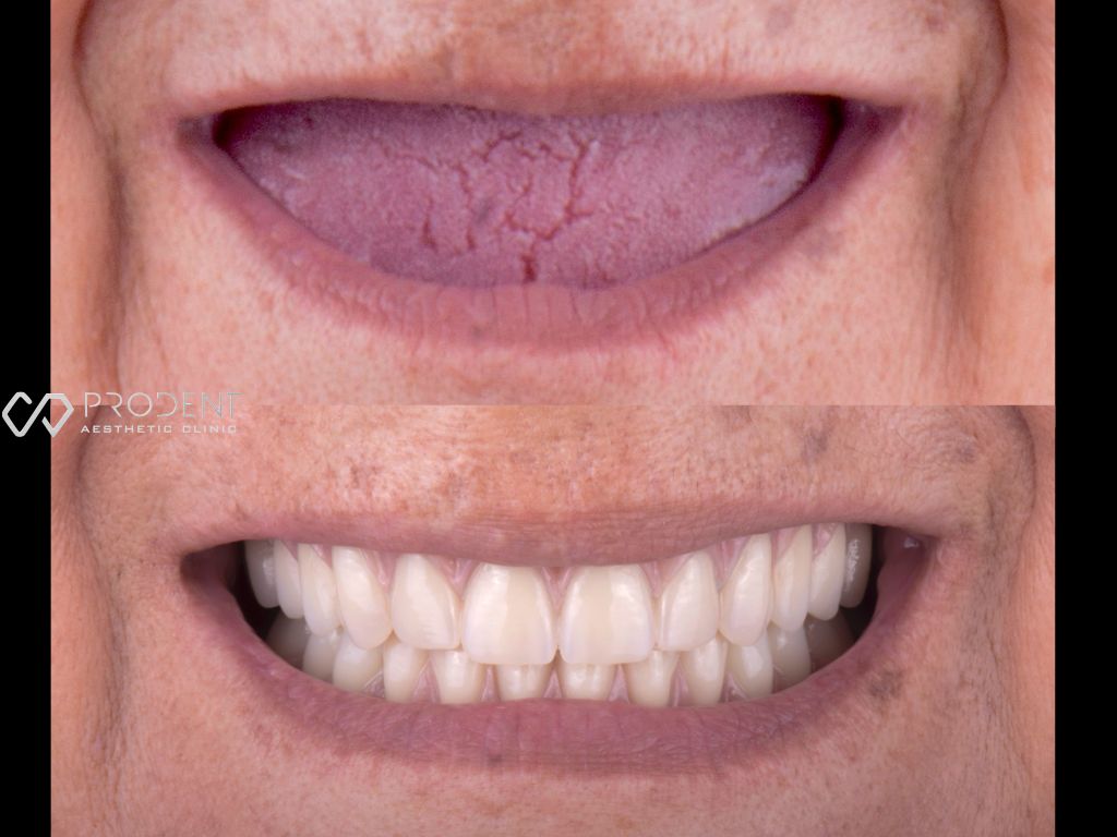 Ulises Pérez Murillo-62