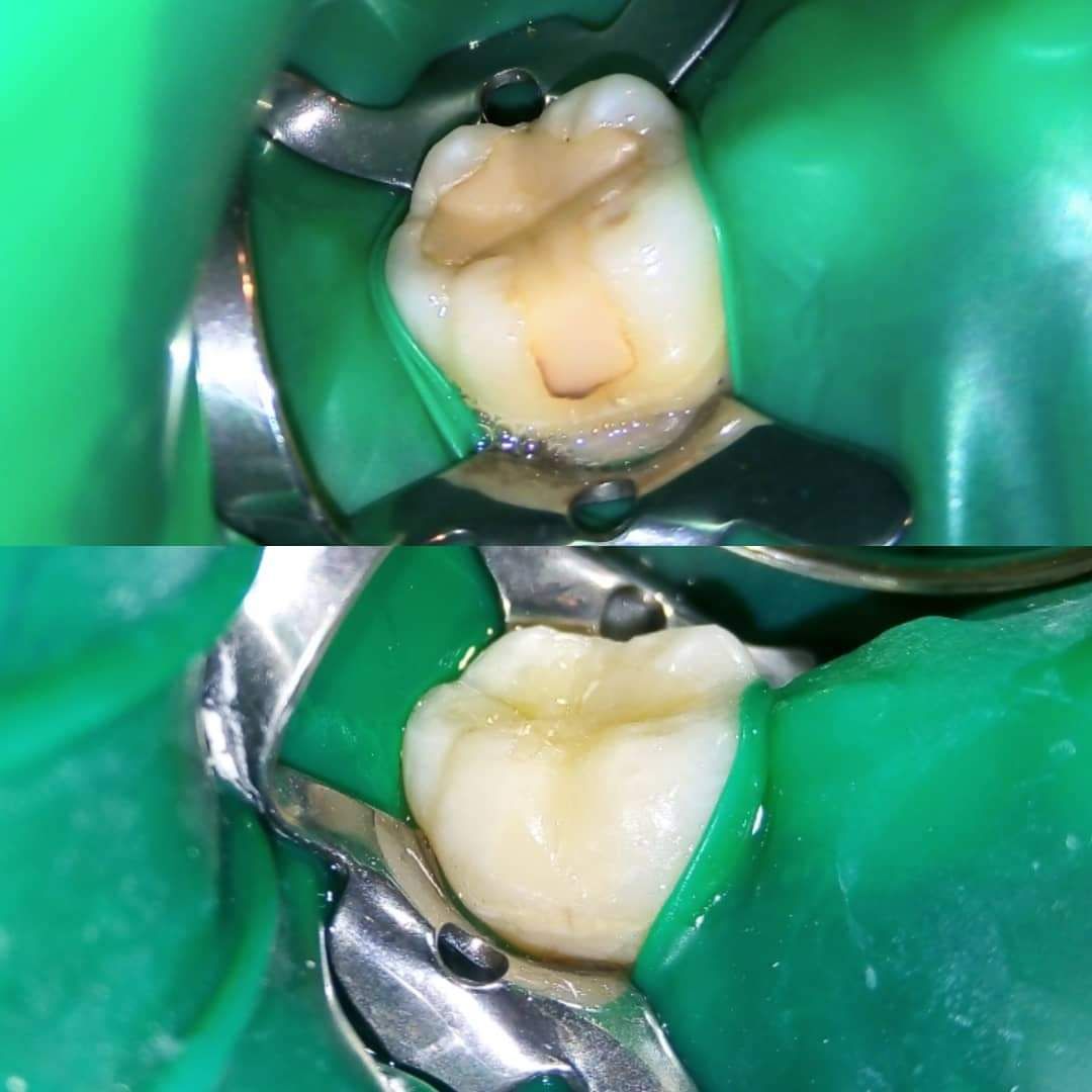 Jacqueline Nuñez Herrera-15