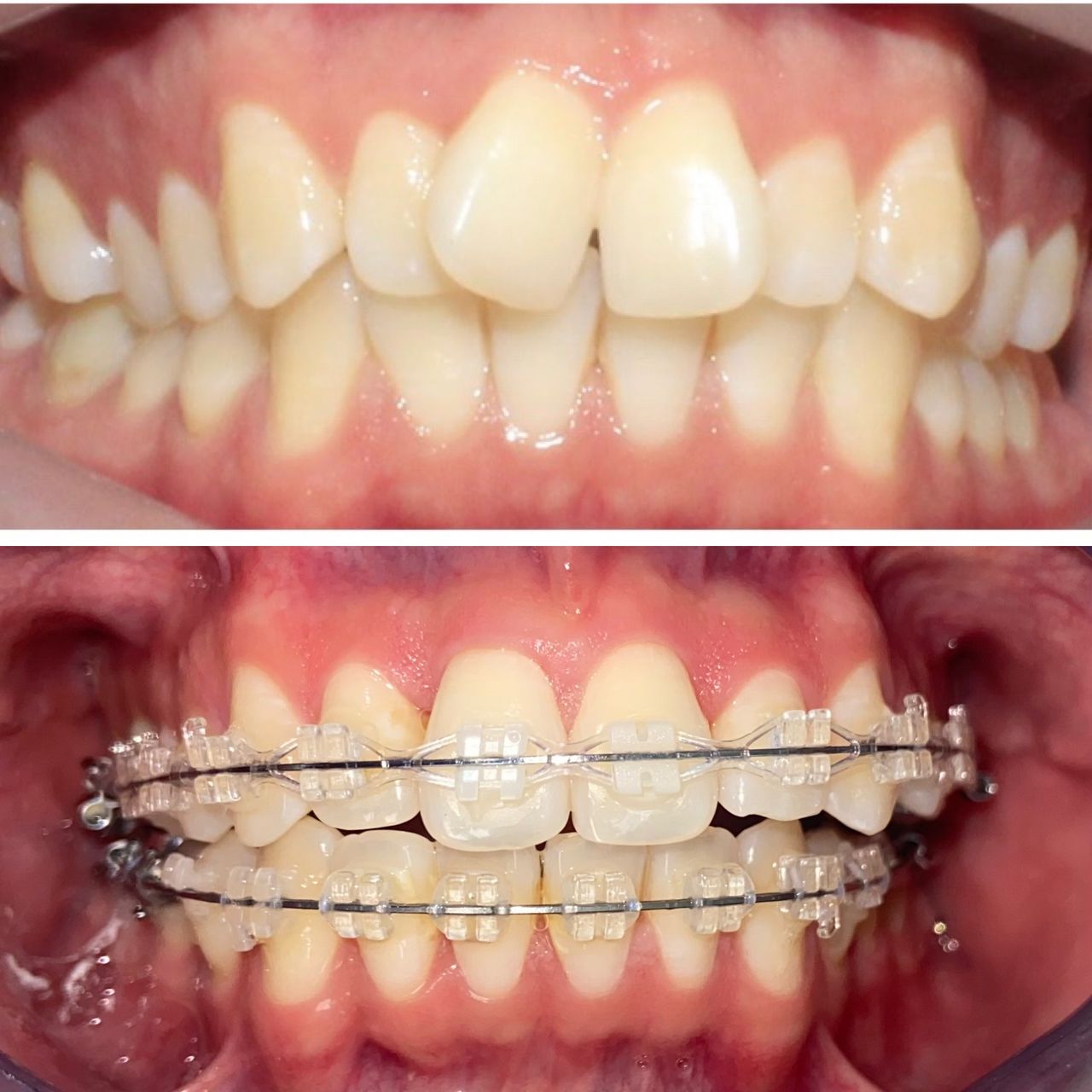 Adriana Moreno Jimenez-9