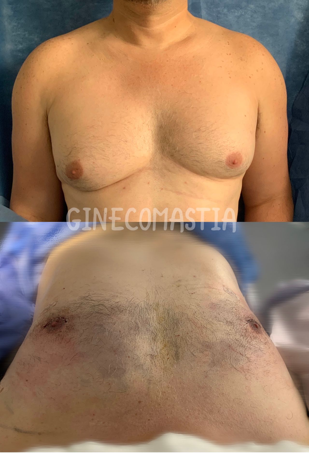 Giuseppe Tanzillo-79