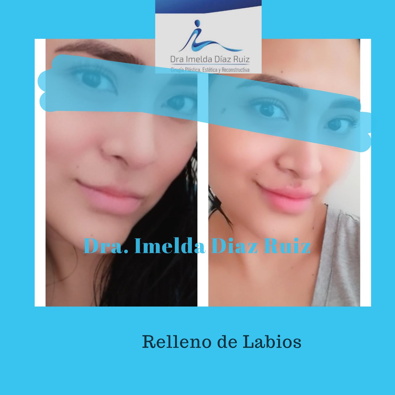 Imelda Díaz Ruiz-12