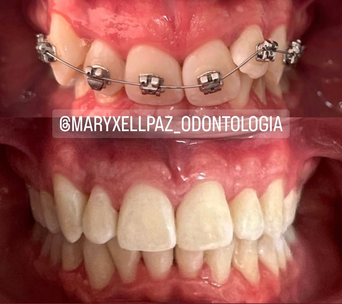 Maryxell Paz González-11