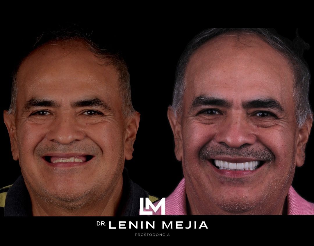 Lenin Mejia-3