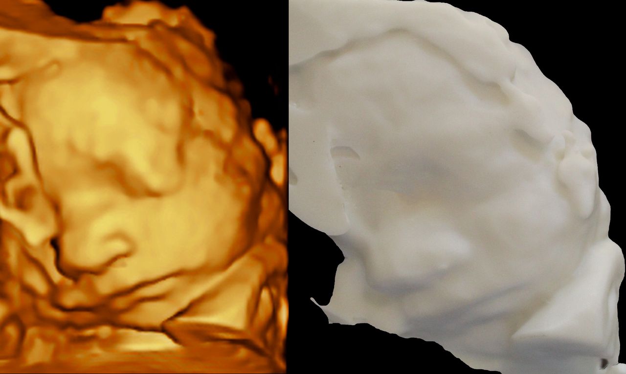 Raul Alejandro Patlan Montalvo-4