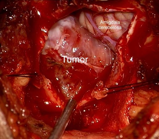 Celia Teresa De Jesús Álvarez Gamiño-33