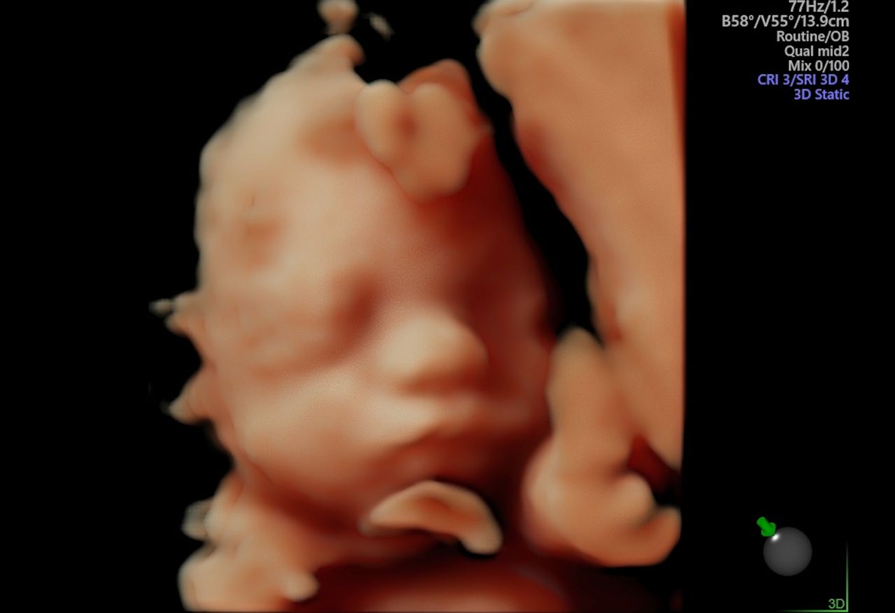 Dulce Anabel Jarquin Arango-44