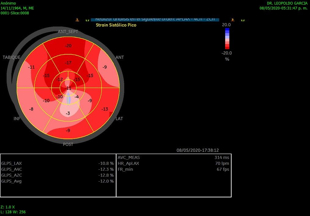 Leopoldo Garcia Lamas-0