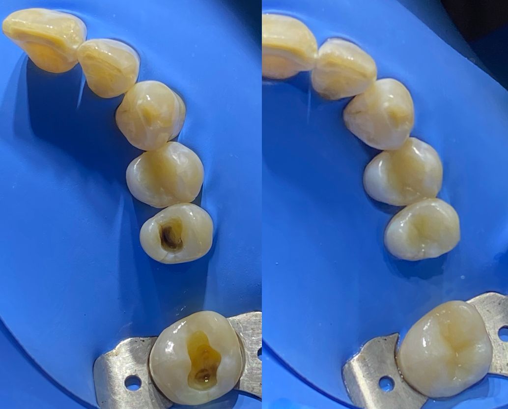 Oscar Justo Bustos-15