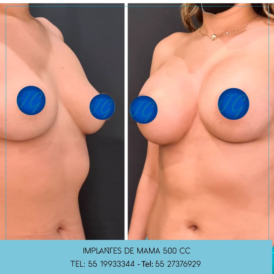 Jhon César Gómez Florez-24