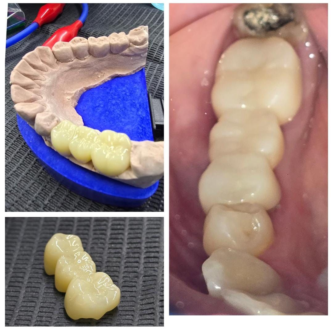 Edgardo Caballero Dávila-32