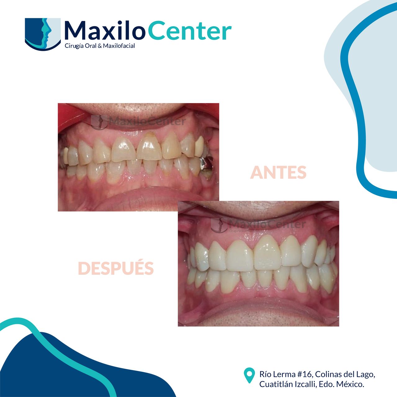 Erick Carrillo Teran-3