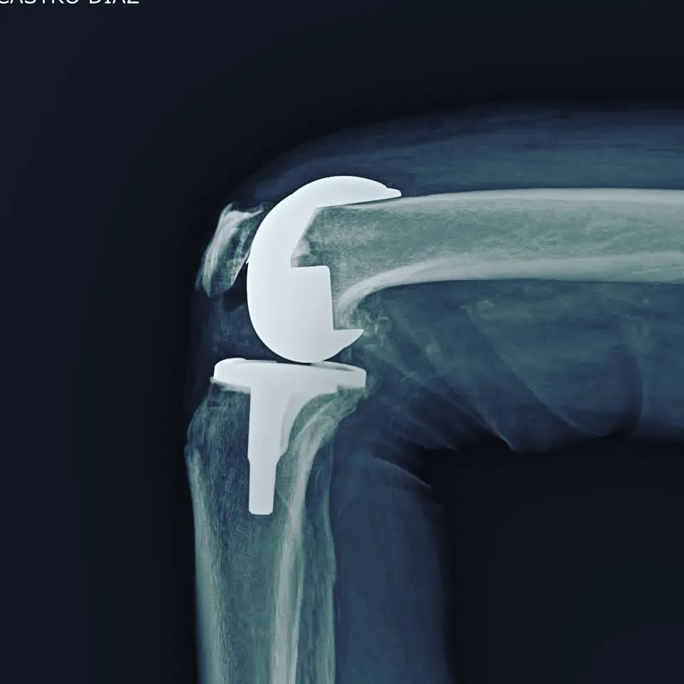 Alejandro Martínez Ramírez-24