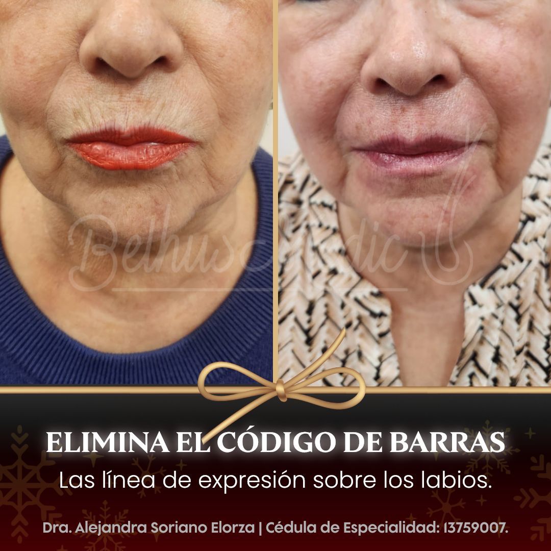 Alejandra Soriano Elorza-80