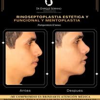 Enrique Serrano Cruz-12
