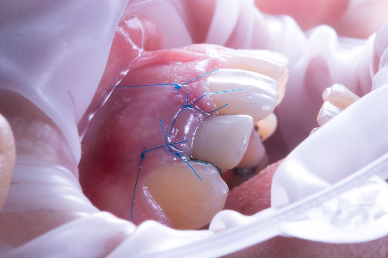 Hugo Enrique Aguilar Lamas-80