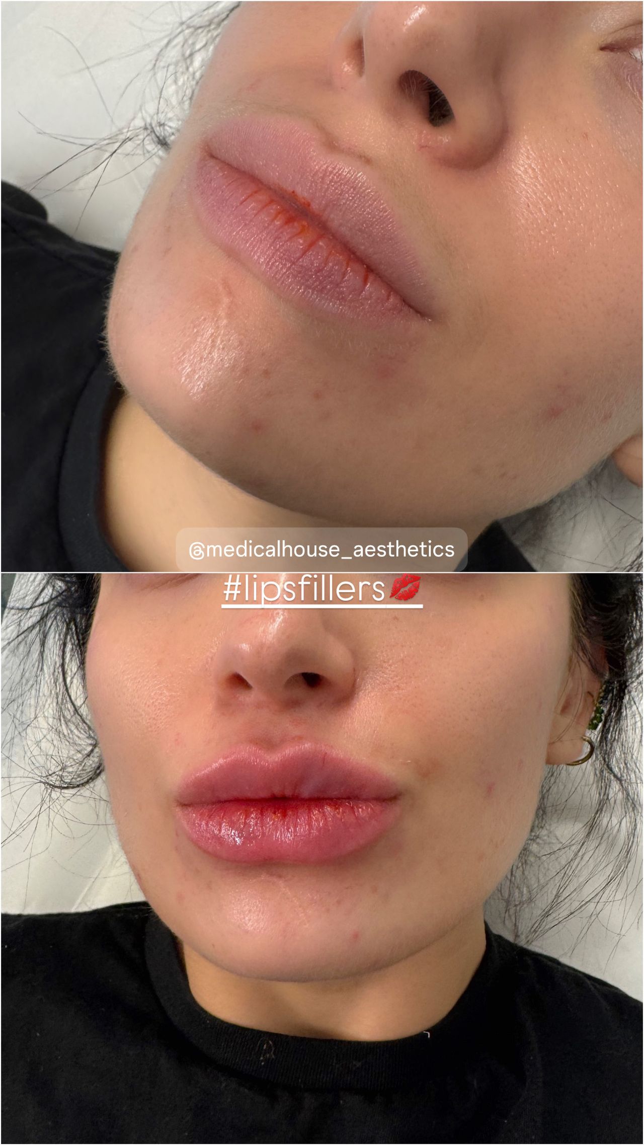 Miguel Angel Aguirre-23