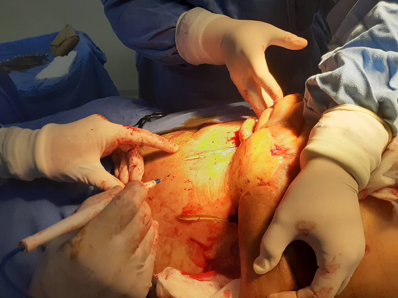 Federico Quintana De La Rosa-51