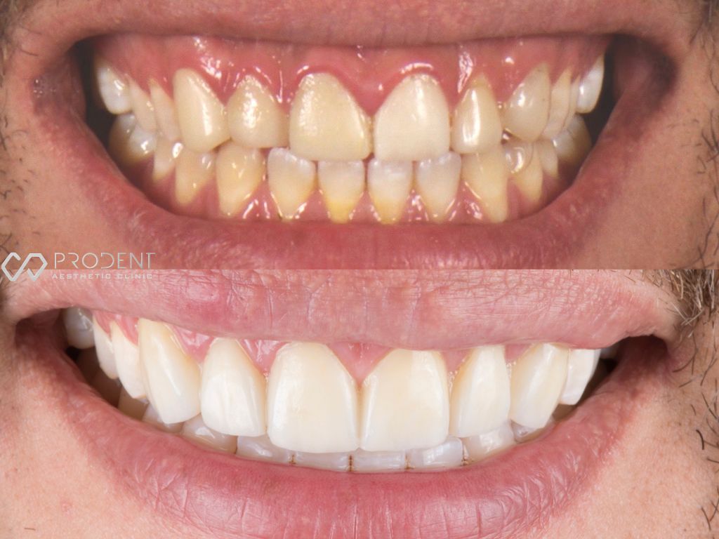 Ulises Pérez Murillo-34