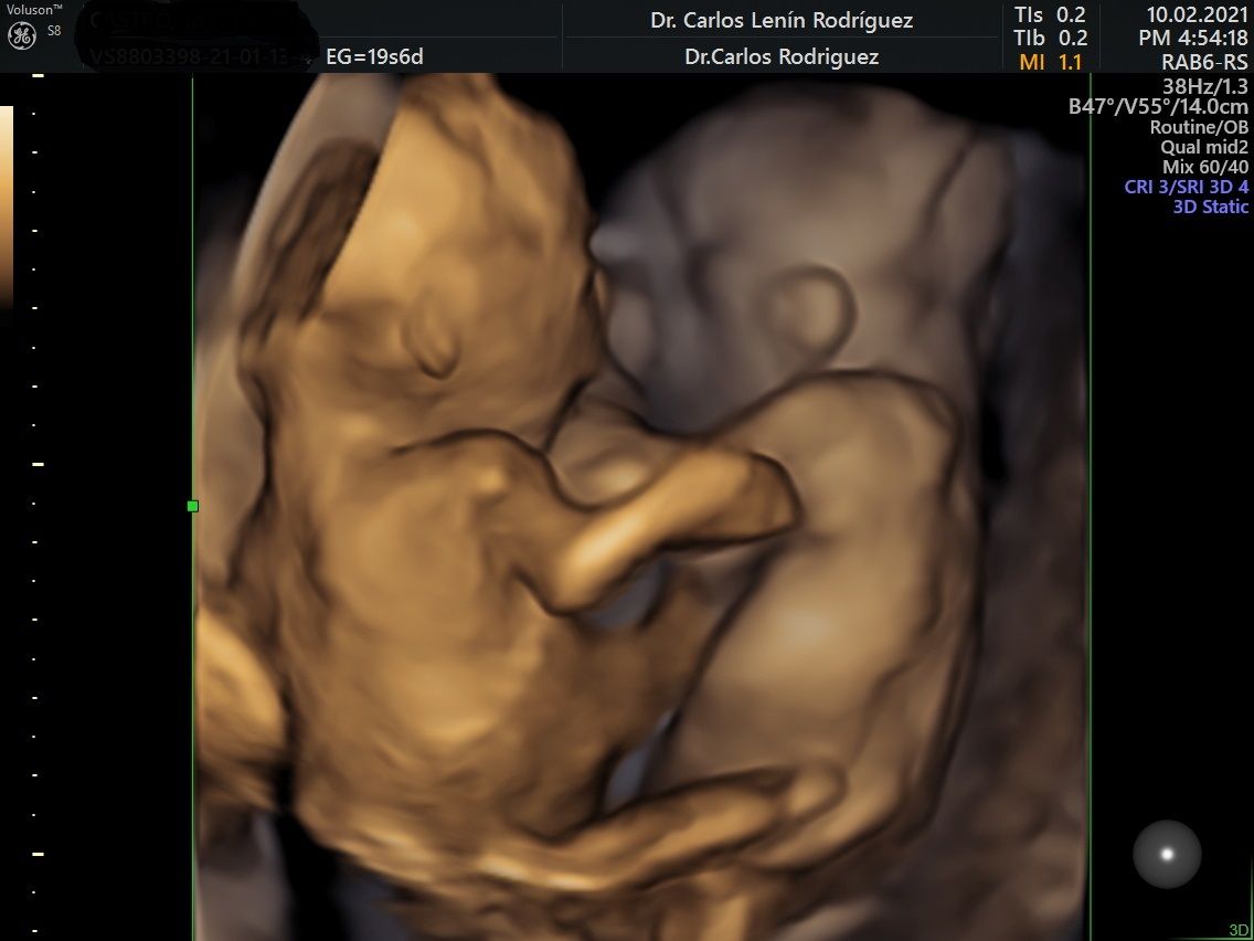 Carlos Lenin Rodriguez Mora-7