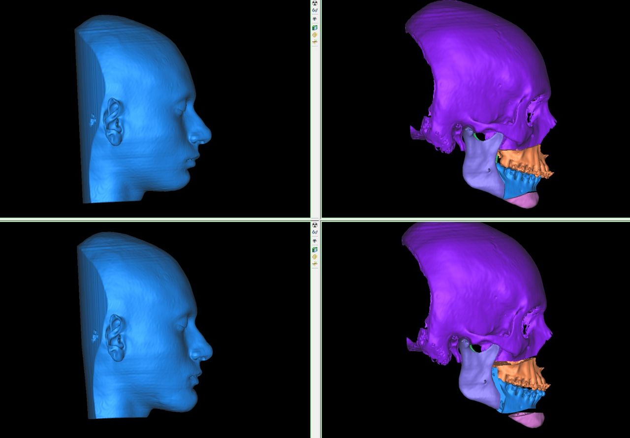 Nancy Valeria Lara Gayosso-21