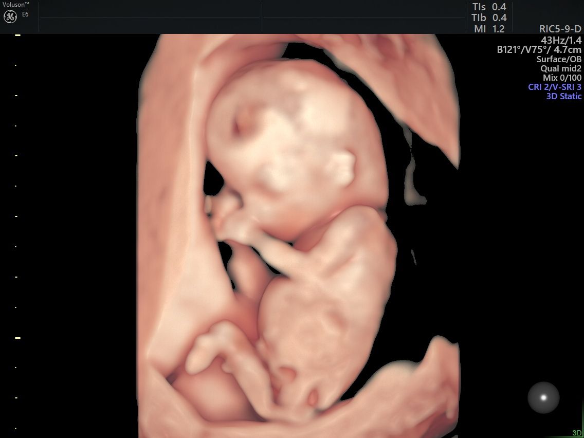 Gila Lili Barrientos Chavez-5