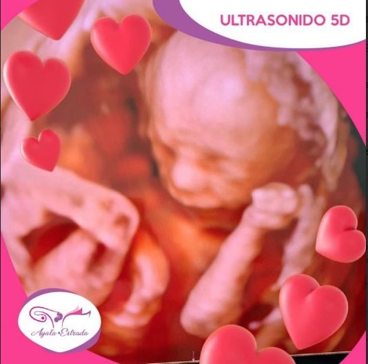 Ana Cecilia Ayala Tejada-5