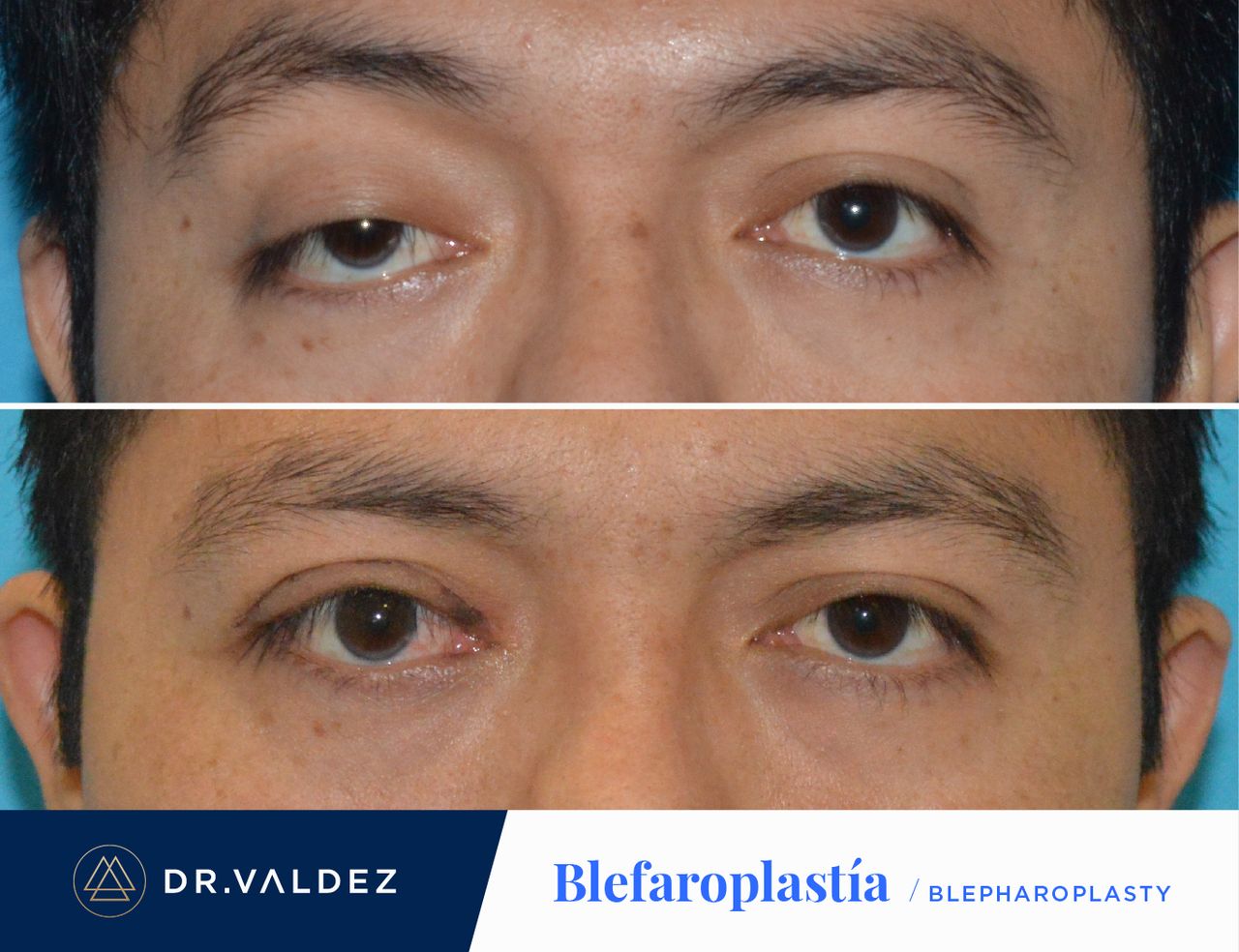 Pedro Arturo Valdez Gomez-33